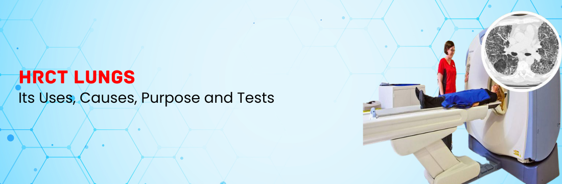 What is HRCT Lungs and Its Uses